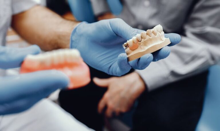 Dental-Implants