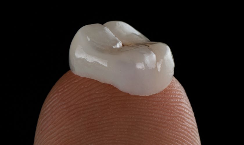 Dental Crowns Boerne TX